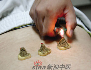 灸法的種類  你知道多少？