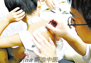 灸法的種類  你知道多少？
